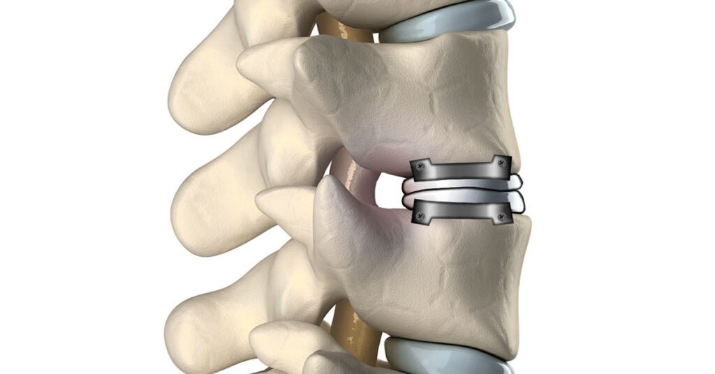 Clinical Illustration