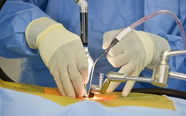 Minimal Invasive Spine Surgery