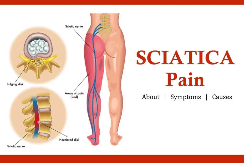 Clinical Illustration