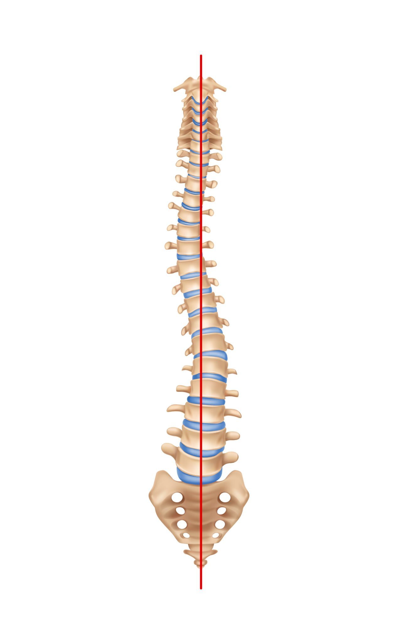 Ankylosing Spondylitis