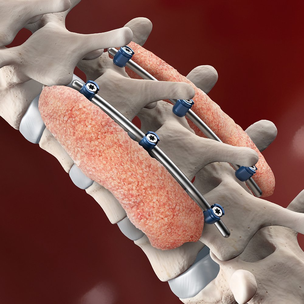 Clinical Illustration