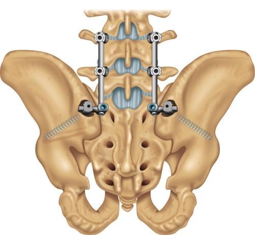 Clinical Illustration