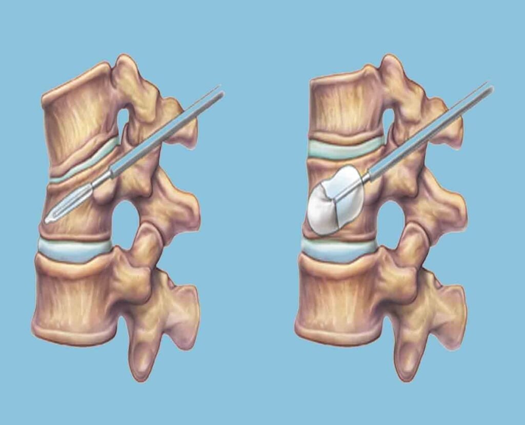 Clinical Illustration